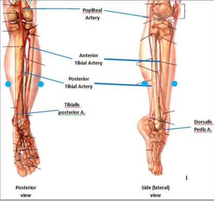 【生理和技术说明】在足和脚踝手术中HemaClear在小腿部位的使用说明